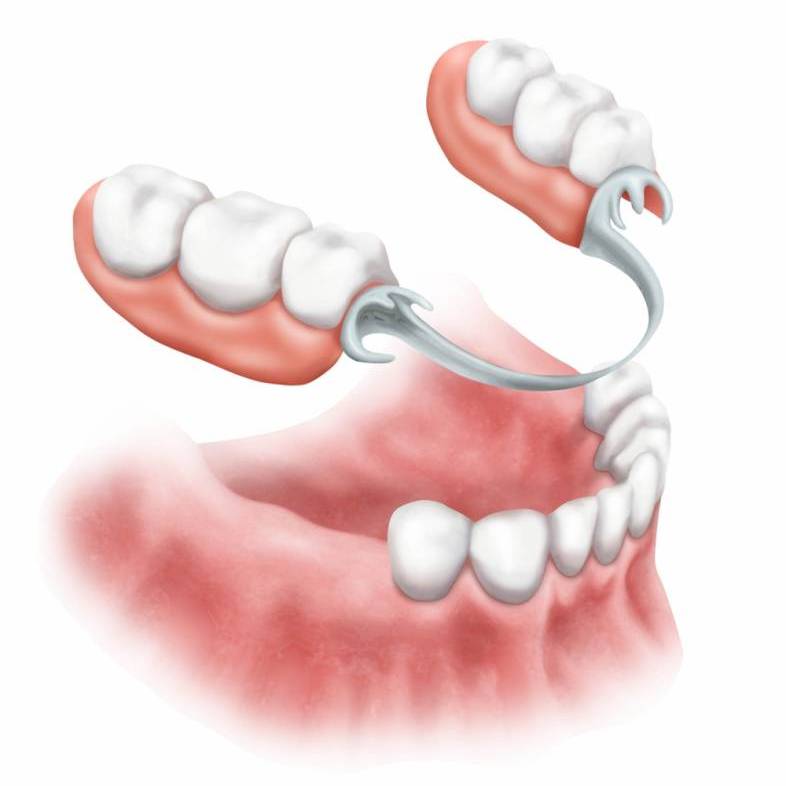 Prótese Dentária