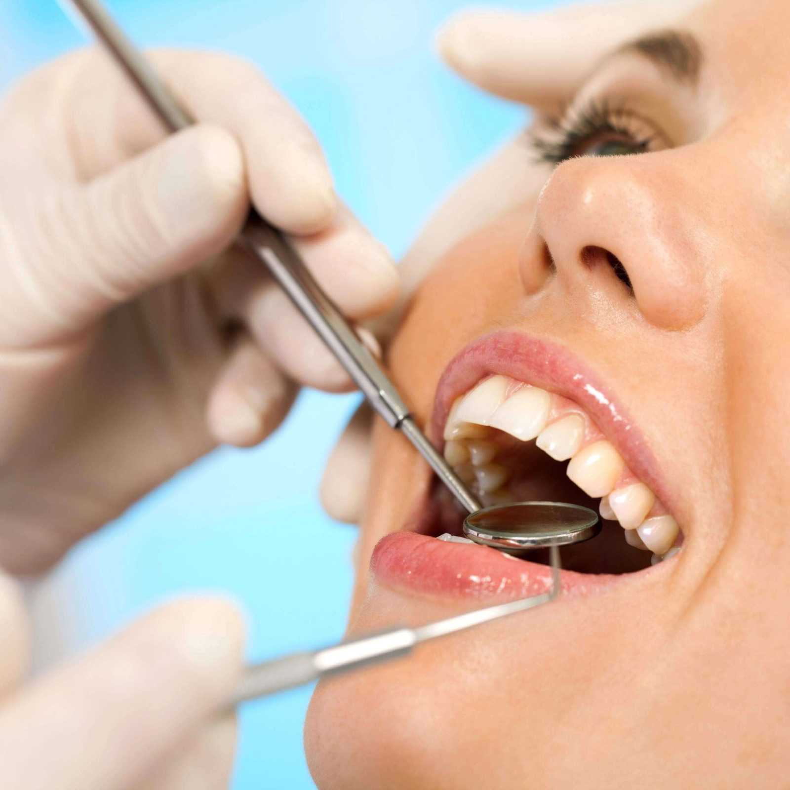 Limpeza dentária em Joinville